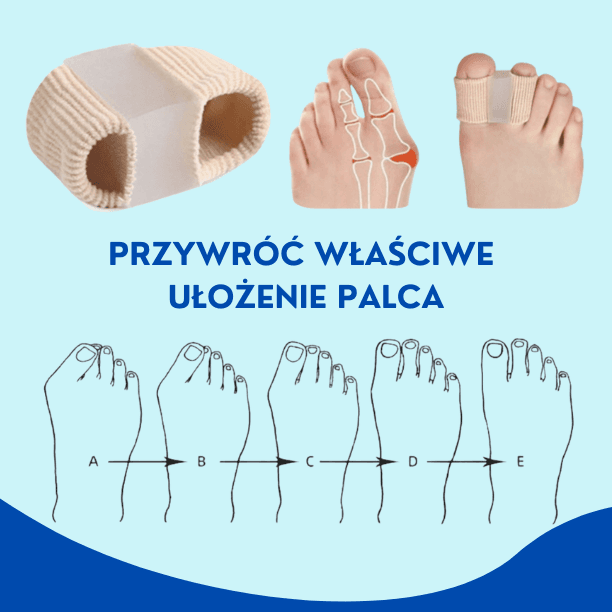 HALLUSTEP-separator palców na haluksy - zestaw 2 szt.